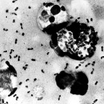 Вспышка эпидемии чумы на Мадагаскаре унесла жизни 39 человек