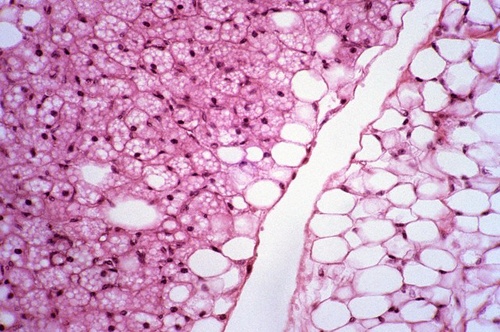 Клетки бурого (слева) и белого (справа) жира (фото Dr. Fred Hossler).