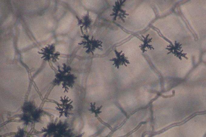 Cladosporium. Фото: © wikipedia.org
