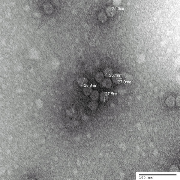 Вирусы, необходимые для термоустойчивости симбиотического комплекса, под электронным микроскопом (фото из дополнительных материалов к обсуждаемой статье в Science)