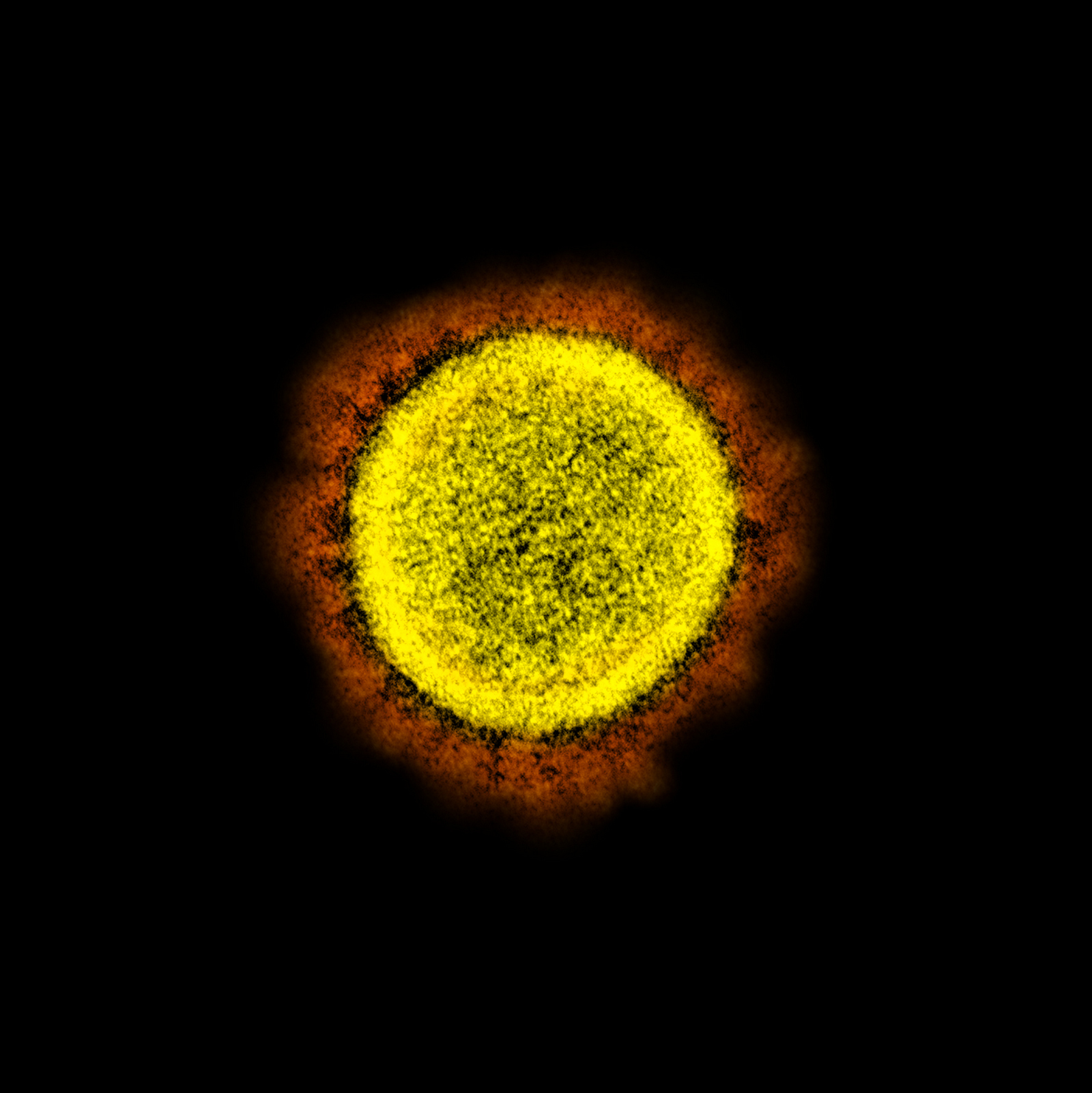 Раскрашенная фотография SARS-CoV-2, полученная на просвечивающем электронном микроскопе. Хорошо видна корона из шипов (красная). Фото Национального института аллергии и инфекционных заболеваний (NIAID) с сайта flickr.com
